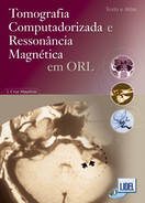 imagem do livro Tomografia Computadorizada E Ressonância Magnética Em Orl - Texto E Atlas