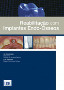 imagem do livro Reabilitação Com Implantes Endo-Ósseos